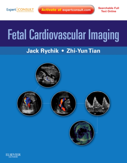 Fetal Cardiovascular Imaging: A Disease Based Approach : Expert Consult Premium Edition: Enhanced Online Features and Print, Hardback Book