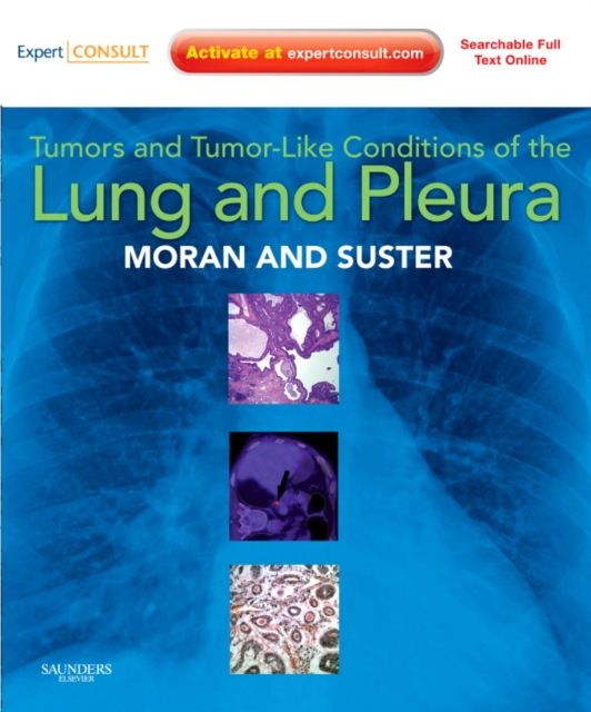 Tumors and Tumor-Like Conditions of the Lung and Pleura, Mixed media product Book