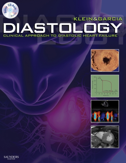 Diastology : Clinical Approach to Diastolic Heart Failure, Hardback Book