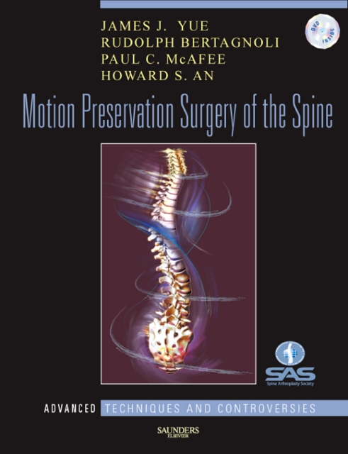 Motion Preservation Surgery of the Spine : Advanced Techniques and Controversies, Mixed media product Book