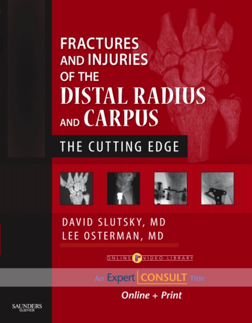 Fractures and Injuries of the Distal Radius and Carpus : The Cutting Edge, Mixed media product Book