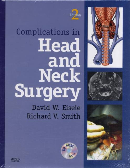 Complications in Head and Neck Surgery, Mixed media product Book