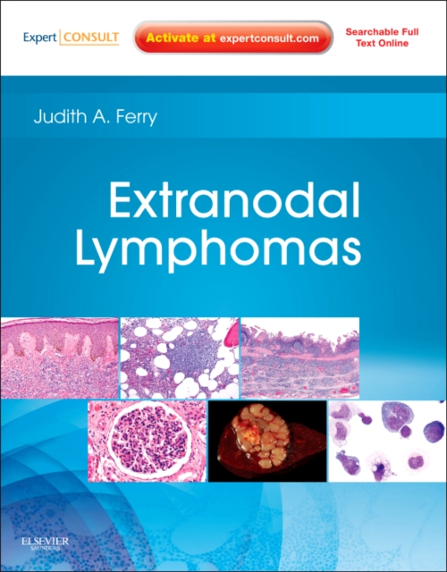 Extranodal Lymphomas : Expert Consult - Online and Print, Hardback Book