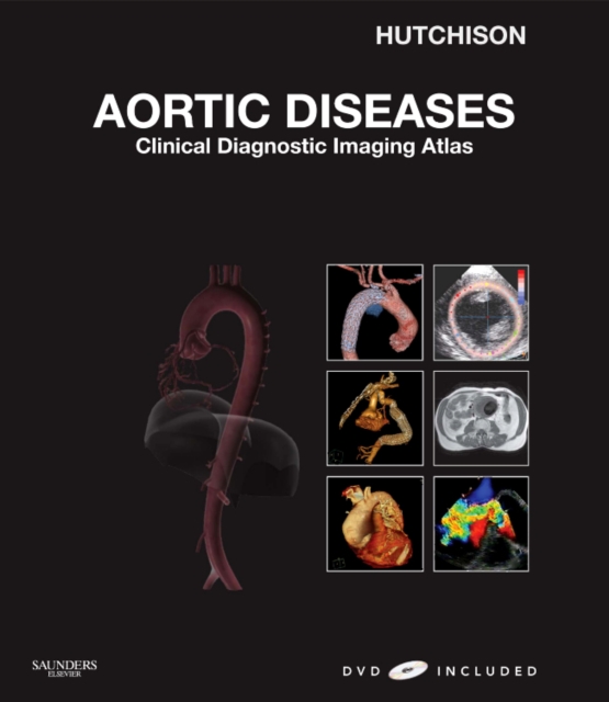 Aortic Diseases : Clinical Diagnostic Imaging Atlas, Mixed media product Book