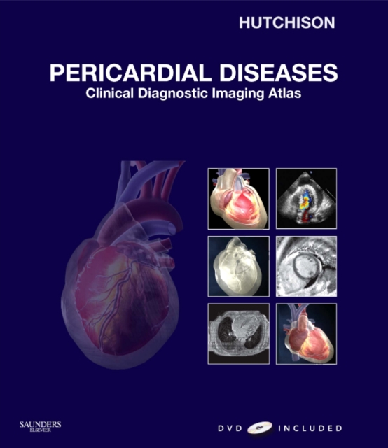 Pericardial Diseases : Clinical Diagnostic Imaging Atlas, Mixed media product Book