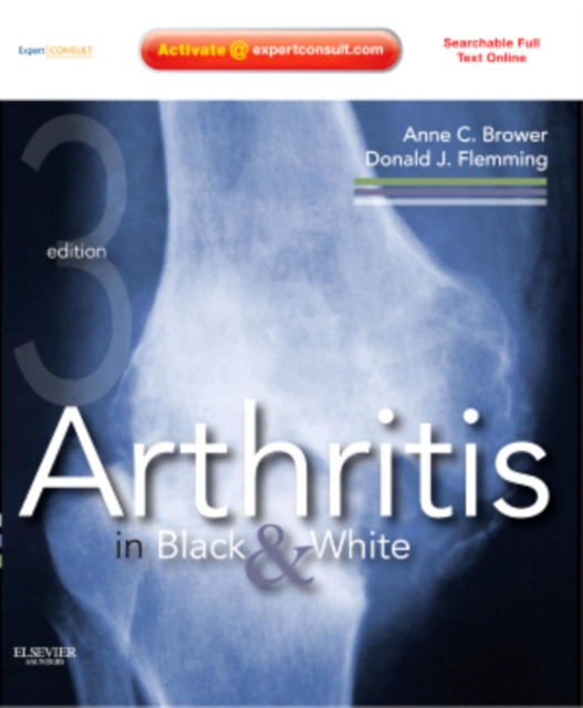 Arthritis in Black and White : Expert Consult - Online and Print, Hardback Book