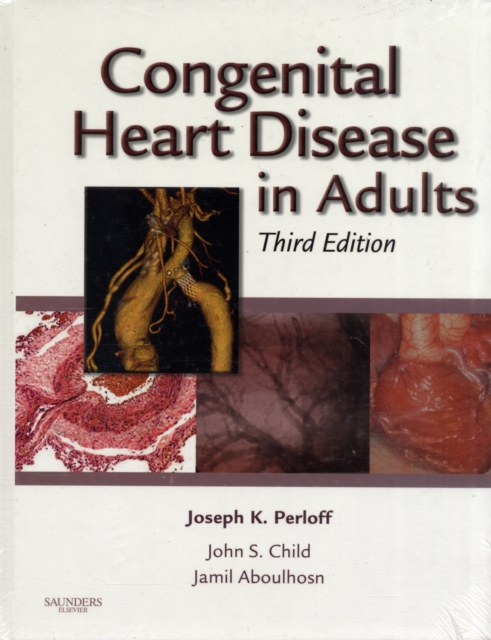 Congenital Heart Disease in Adults, Hardback Book