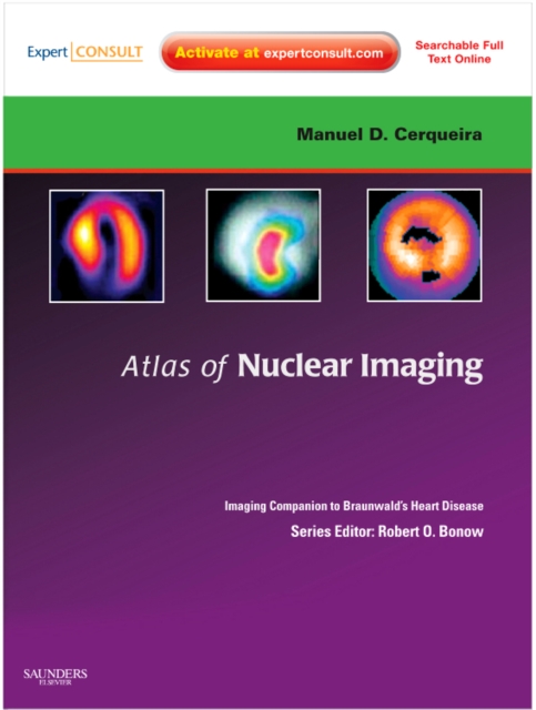 Atlas of Nuclear Cardiology: Imaging Companion to Braunwald's Heart Disease : Expert Consult - Online and Print, Hardback Book