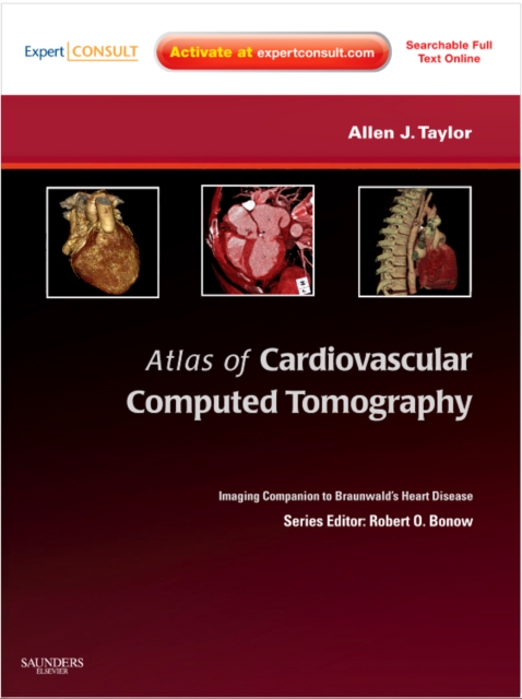 Atlas of Cardiovascular Computed Tomography : Imaging Companion to Braunwald's Heart Disease, Mixed media product Book
