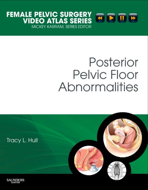 Posterior Pelvic Floor Abnormalities, Hardback Book