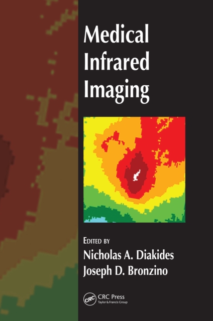 Medical Infrared Imaging, PDF eBook