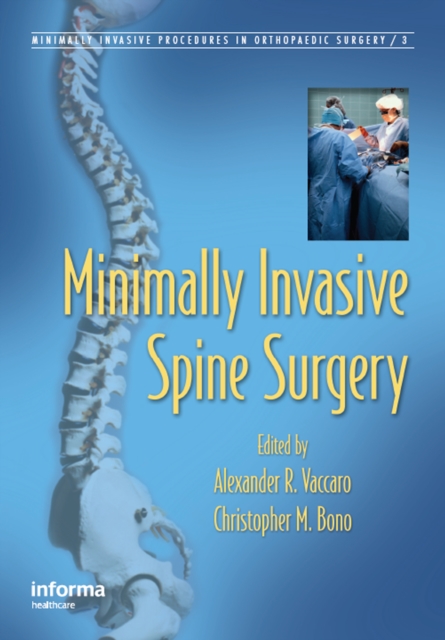 Minimally Invasive Spine Surgery, PDF eBook