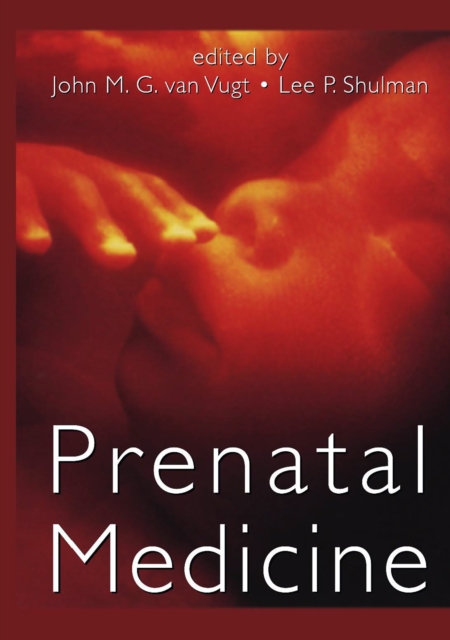 Prenatal Medicine, PDF eBook