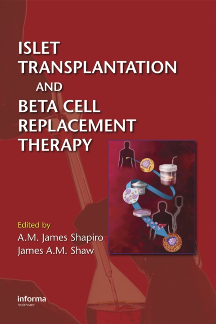Islet Transplantation and Beta Cell Replacement Therapy, PDF eBook