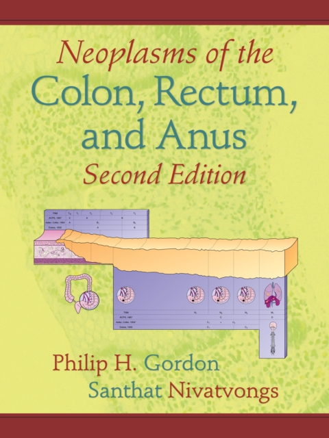 Neoplasms of the Colon, Rectum, and Anus, PDF eBook