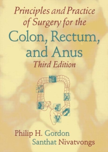 Principles and Practice of Surgery for the Colon, Rectum, and Anus, PDF eBook