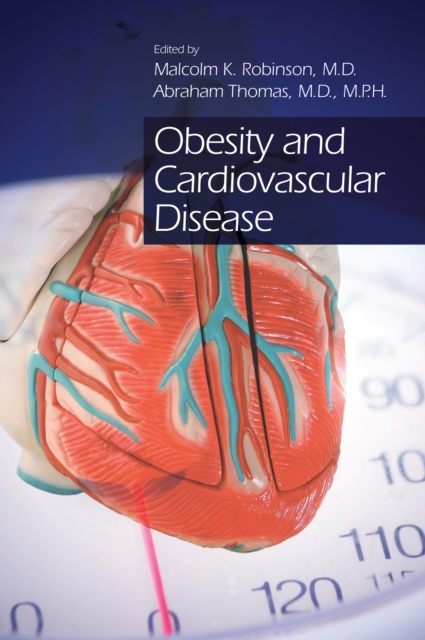 Obesity and Cardiovascular Disease, PDF eBook