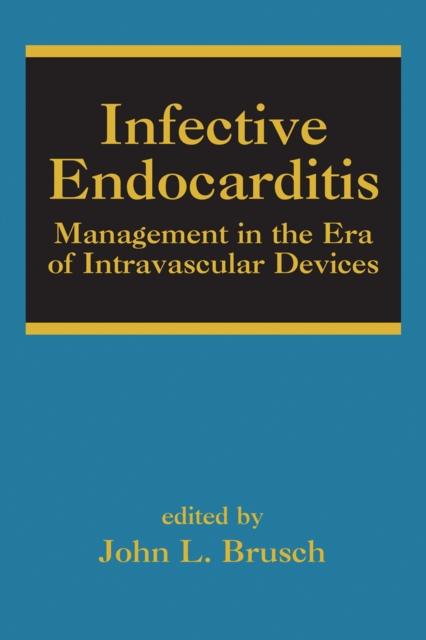 Infective Endocarditis : Management in the Era of Intravascular Devices, PDF eBook