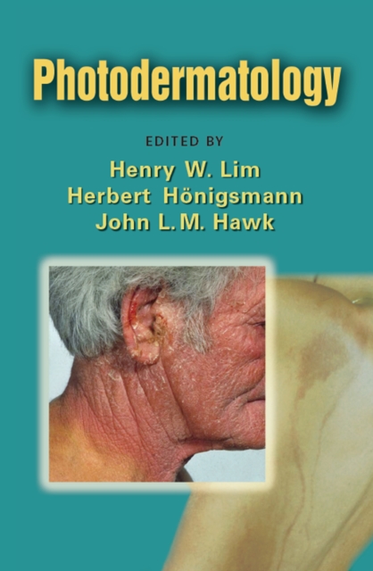 Photodermatology, PDF eBook