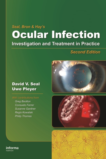 Ocular Infection : Investigation and Treatment in Practice, PDF eBook