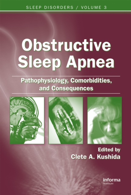 Obstructive Sleep Apnea: Pathophysiology, Comorbidities and Consequences : Pathophysiology, Comorbidities, and Consequences, PDF eBook