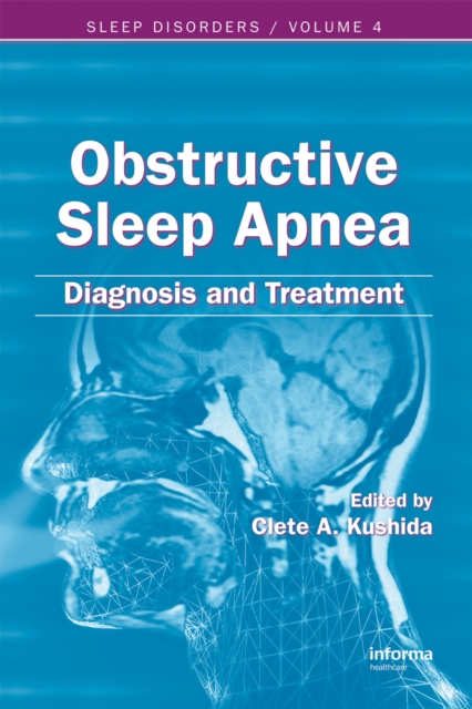 Obstructive Sleep Apnea : Diagnosis and Treatment, PDF eBook