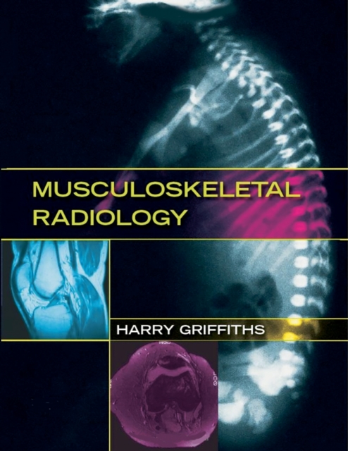 Musculoskeletal Radiology, PDF eBook