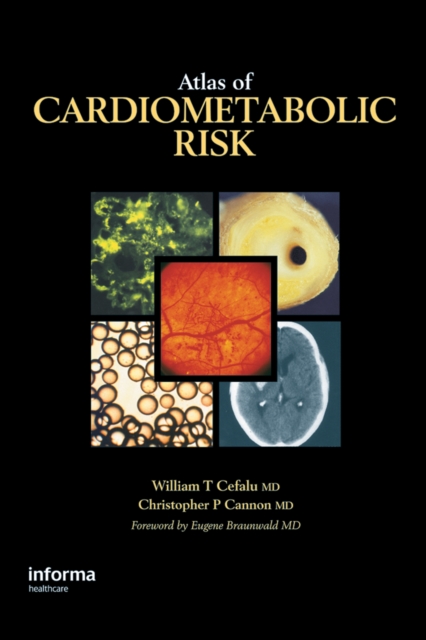 Atlas of Cardiometabolic Risk, PDF eBook