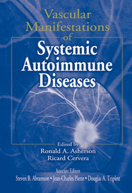 Vascular Manifestations of Systemic Autoimmune Diseases, PDF eBook