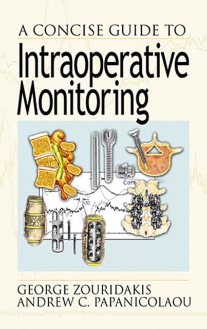 A Concise Guide to Intraoperative Monitoring, PDF eBook