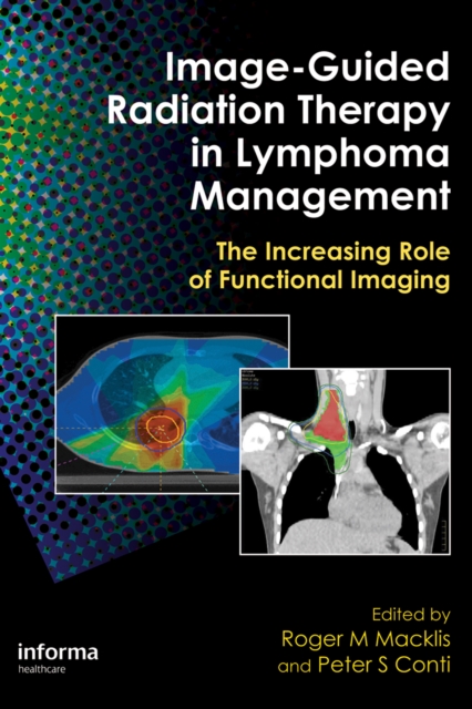 Image-Guided Radiation Therapy in Lymphoma Management : The Increasing Role of Functional Imaging, PDF eBook