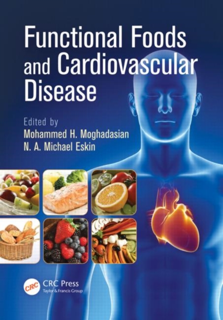 Functional Foods and Cardiovascular Disease, Hardback Book