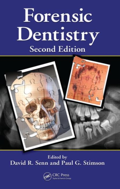 Forensic Dentistry, Hardback Book