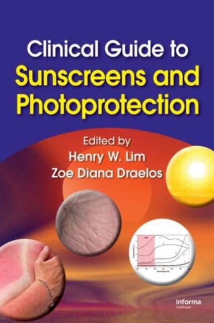 Clinical Guide to Sunscreens and Photoprotection, Hardback Book