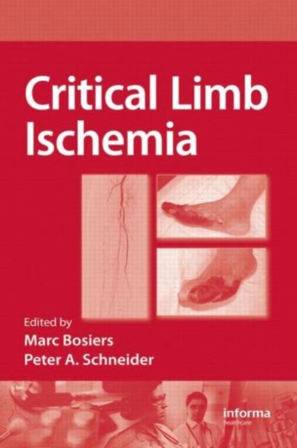 Critical Limb Ischemia, Hardback Book