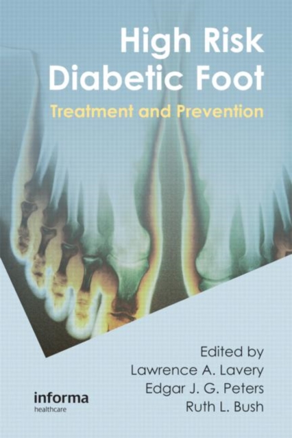 High Risk Diabetic Foot : Treatment and Prevention, Hardback Book