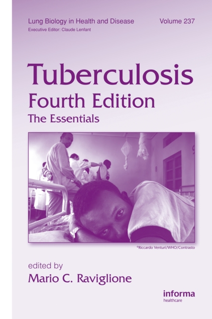 Tuberculosis : The Essentials, Fourth Edition, PDF eBook