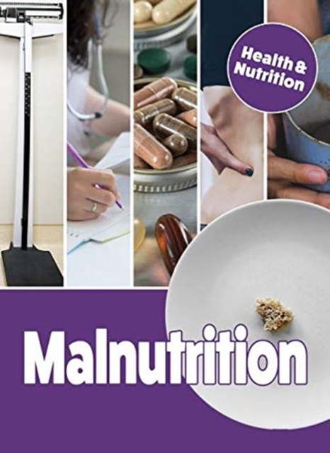 Malnutrition, Hardback Book