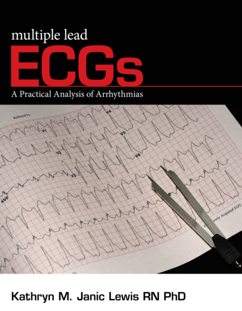 Multiple Lead ECGs : A Practical Analysis of Arrhythmias, Mixed media product Book