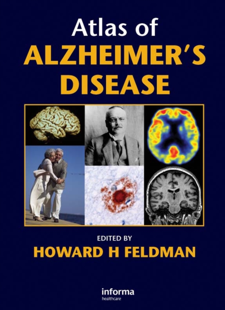 Atlas of Alzheimer's Disease, PDF eBook