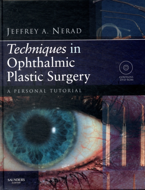 Techniques in Ophthalmic Plastic Surgery : A Personal Tutorial, Hardback Book