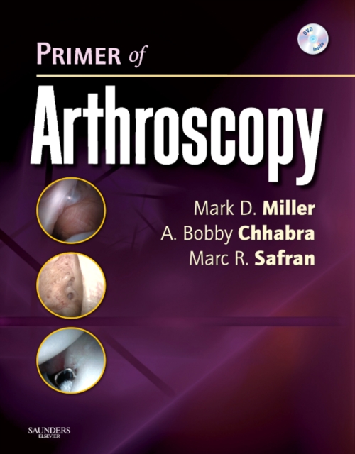 Primer of Arthroscopy, Mixed media product Book