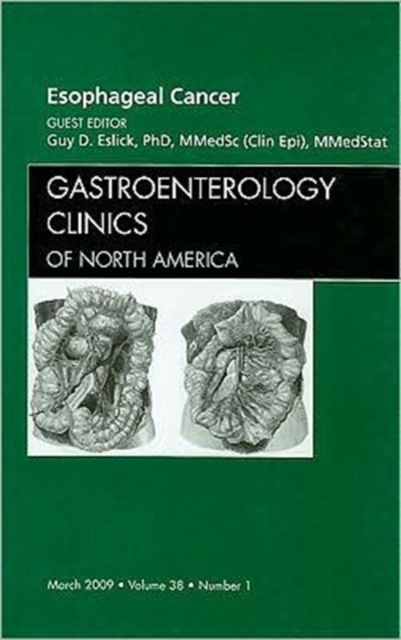 Esophageal Cancer, An Issue of Gastroenterology Clinics : Volume 38-1, Hardback Book