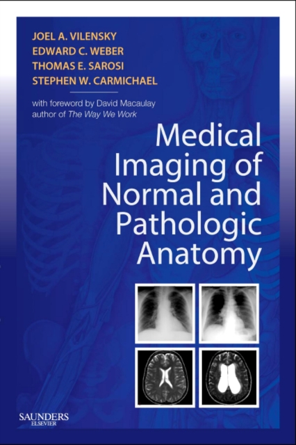 Medical Imaging of Normal and Pathologic Anatomy, Paperback / softback Book