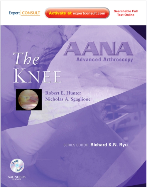 AANA Advanced Arthroscopy: The Knee : Expert Consult: Online, Print and DVD, Hardback Book