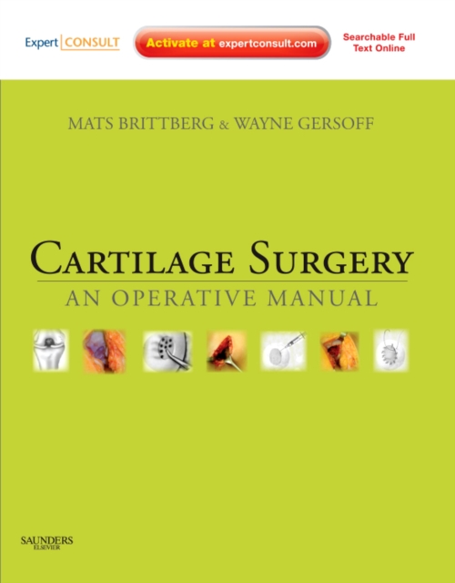 Cartilage Surgery : An Operative Manual, Expert Consult: Online and Print, Hardback Book
