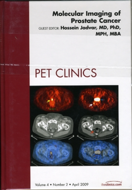 Molecular Imaging of Prostate Cancer, An Issue of PET Clinics : Volume 4-2, Hardback Book