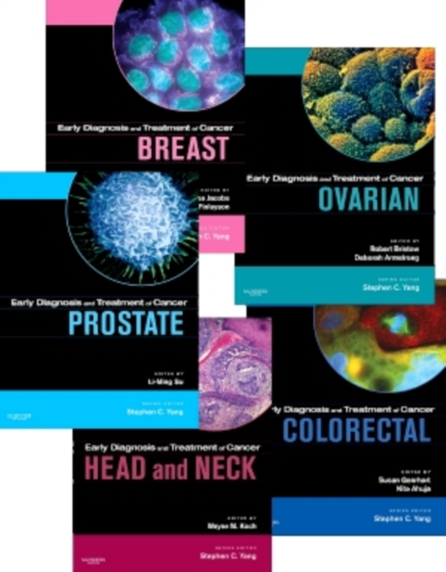 Breast Cancer, Colorectal Cancer, Head and Neck Cancers, Ovarian Cancer, and Prostate Cancer : Package, Mixed media product Book