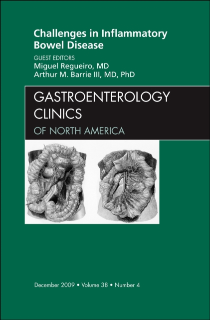 Challenges in Inflammatory Bowel Disease, An Issue of Gastroenterology Clinics : Volume 38-4, Hardback Book