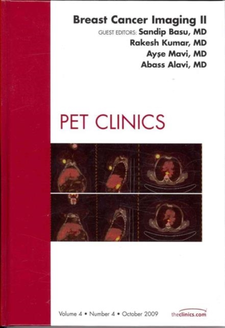 Breast Cancer Imaging II, An Issue of PET Clinics : Volume 4-4, Hardback Book